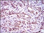 DNAL4 Antibody in Immunohistochemistry (Paraffin) (IHC (P))