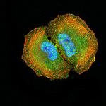 DAB2 Monoclonal Antibody (2H7C4)