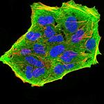 GFPT1 Monoclonal Antibody (1F1A4)