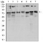 GFPT1 Antibody in Western Blot (WB)