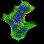 GFPT1 Monoclonal Antibody (1F1B9)