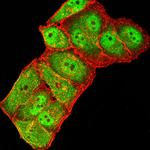 GluR7 Monoclonal Antibody (2B3D1)