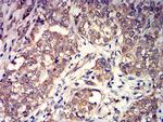 mGluR3 Antibody in Immunohistochemistry (Paraffin) (IHC (P))