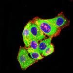 mGluR3 Monoclonal Antibody (7A5A6)