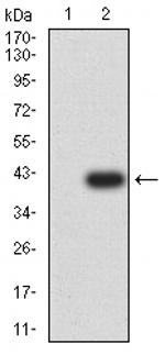 mGluR6 Monoclonal Antibody (7D9C9)