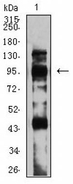 mGluR8 Antibody in Western Blot (WB)