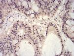 H3K27ac Antibody in Immunohistochemistry (Paraffin) (IHC (P))