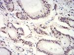 H3K27ac Antibody in Immunohistochemistry (Paraffin) (IHC (P))