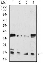 H3K27ac Antibody in Western Blot (WB)