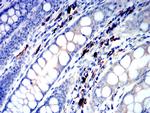 IGLC2 Antibody in Immunohistochemistry (Paraffin) (IHC (P))