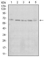 KBTBD8 Monoclonal Antibody (7G8A6)
