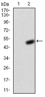 KV4.2 (KCND2) Monoclonal Antibody (5B11B9)