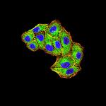 MIB1 Monoclonal Antibody (6A9C9)