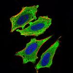 ChREBP Antibody in Immunocytochemistry (ICC/IF)