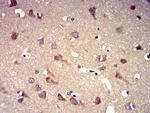 P2Y8 Antibody in Immunohistochemistry (Paraffin) (IHC (P))