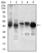 PDK2 Monoclonal Antibody (3F2D7)