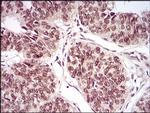 PER3 Antibody in Immunohistochemistry (Paraffin) (IHC (P))