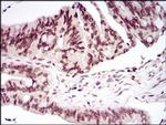 PER3 Antibody in Immunohistochemistry (Paraffin) (IHC (P))