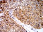 PGRMC1 Antibody in Immunohistochemistry (Paraffin) (IHC (P))