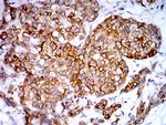 PGRMC1 Antibody in Immunohistochemistry (Paraffin) (IHC (P))
