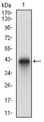 PLAGL1 Antibody in Western Blot (WB)