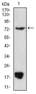 PRDM5 Antibody in Western Blot (WB)