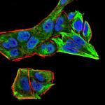 RAB13 Monoclonal Antibody (7G8A4)