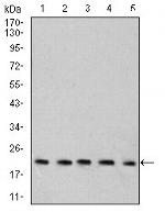 RAB6B Antibody in Western Blot (WB)