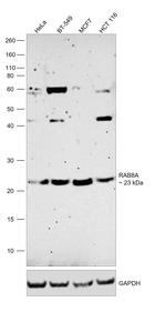 RAB8A Monoclonal Antibody (7G8B11)