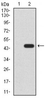 RAD52 Monoclonal Antibody (5E11B2)