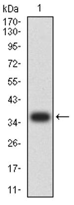 RIPK4 Antibody in Western Blot (WB)