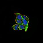 ARHE Monoclonal Antibody (5C7E8)