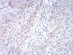 ARHE Antibody in Immunohistochemistry (Paraffin) (IHC (P))