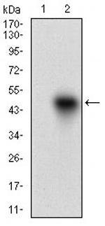 ROR2 Monoclonal Antibody (6F2D10)