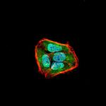 SSH1 Monoclonal Antibody (1A5C8)