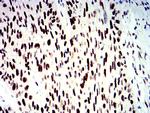 SMARCA1 Antibody in Immunohistochemistry (Paraffin) (IHC (P))