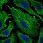 SMCP Monoclonal Antibody (5C10D8)
