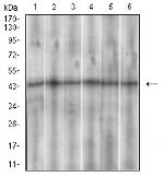SSTR3 Monoclonal Antibody (7H8E5)