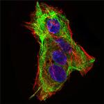 SCP3 Monoclonal Antibody (6F9B6)