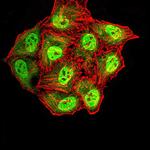 Synapsin 1 Monoclonal Antibody (7B1D9)