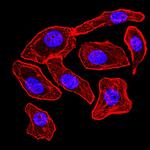 Synapsin 1 Antibody in Immunocytochemistry (ICC/IF)