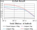 TUBB2A Antibody in ELISA (ELISA)