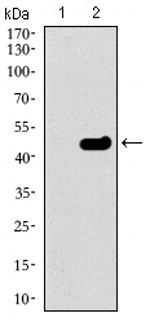 TUBB2A Antibody in Western Blot (WB)