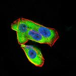 UCP2 Monoclonal Antibody (3F1B9)