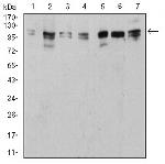 ULK2 Monoclonal Antibody (2H4B2)