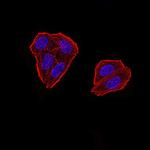ZFP91 Antibody in Immunocytochemistry (ICC/IF)