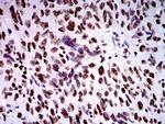 ZFP91 Antibody in Immunohistochemistry (Paraffin) (IHC (P))