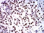 ZFP91 Antibody in Immunohistochemistry (Paraffin) (IHC (P))