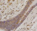 BAD Antibody in Immunohistochemistry (Paraffin) (IHC (P))