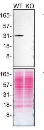CDK5 Antibody